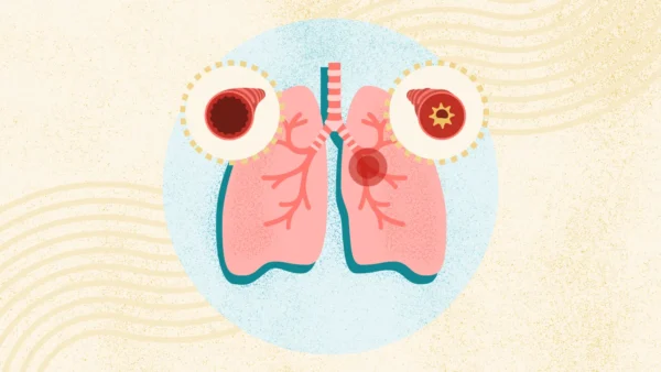 How Allergies and Asthma Interact