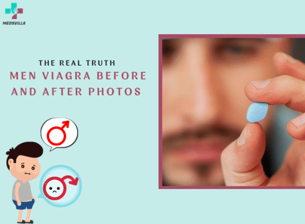 The Truth About Viagra Before and After Results